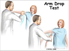 Drop Arm
