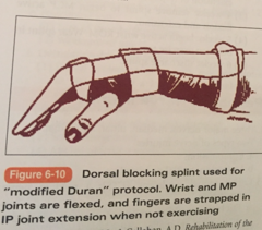 Early Mobilization Protocols for Flexor Tendons:  ___1___: Passive flexion & extension of digit