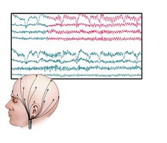 EEG test