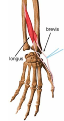 Extension of CMC & MCP of thumb