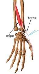 Extension of IP of thumb