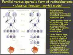 Familial versus sporadic form of retinoblastoma - classical Knudson two-hit model (2014)