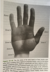 Flexor Tendon Zones?