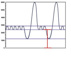 functional residual capacity