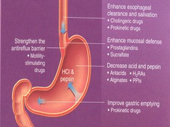 GERD Pathophysiology-based Pharmacologic Treatment