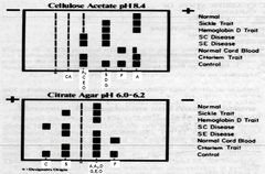 Hemoglobin Electrophoresis