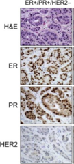 Histological studies for BC