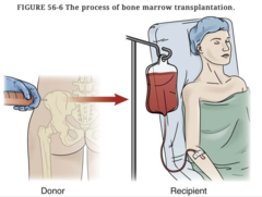 How is bone marrow given to the patient?