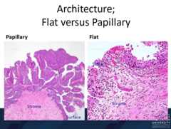 How would you describe papillary architecture? Flat?