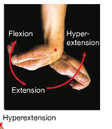 hyper extension