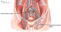 internal iliac lymph nodes drain