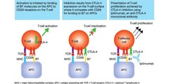 Ipilimumab