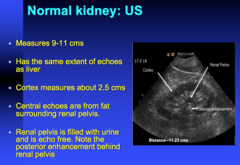 kidney should have same echogenicity as what?  central echoes in the kidney are from what?  why is the renal pelvis echo free?