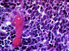 Kulchitsky cells