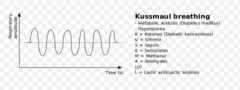 Kussmaul's breathing