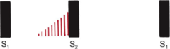 Late systolic murmur