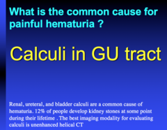 most common cause for painful hematuria?  what's the best way to image it?