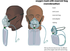 Nonrebreather face mask