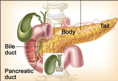 pancreas head Adenocarcinoma Clinical Presentation