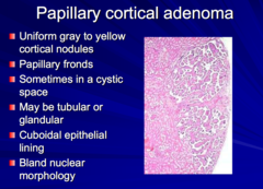 Papillary cortical adenoma  Is it a kidney or bladder tumor?  Benign or malignant? What's the usual size (size based definition)?