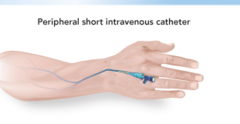 peripheral IV therapy