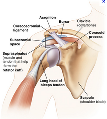 Rotator cuff tendonitis