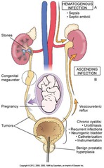 Routes of Renal Infection