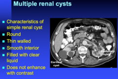 simple renal cyst criteria  do they enhance with contrast?