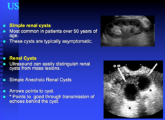 simple renal cysts are common over what age?  what else can look like cysts and how do you distinguish the 2?
