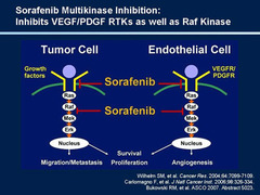 Sorafenib