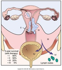 Staging of Endometrial Carcinoma