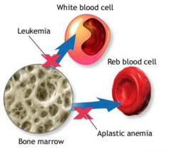 Stem Cell Transplantation