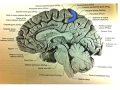 Stroke Findings in Parietal Temporal Lobe