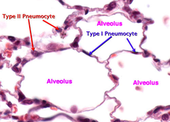 type II pneumocytes