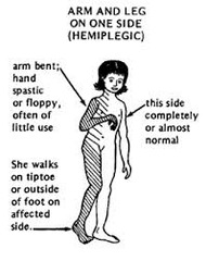 Typical posture of UE (3)