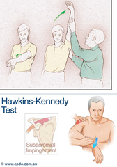 What are Key physical exam maneuvers for diagnosing Shoulder Pain With Impingement