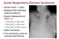 What are likely findings on CXR of ARDS?