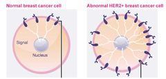 What are the characteristics of the HER 2+ (HER2 enriched) molecular sutypes of invasive carcinoma?
