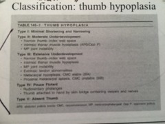 What are the five different types of thumb hypoplasia and what is the name of this classification system?