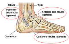 What are the types of Ankle sprains