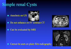 what do simple renal cysts look like on US, CT, MRI, Xray?  do they contrast enhance?