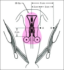 What does point A represent