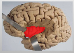 What does the insular cortex do? Where is it located?