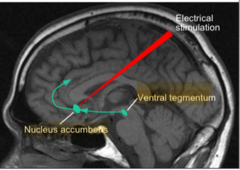 What does the nucleus accumbens do? Where is it located?