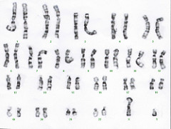 What is a karyotype