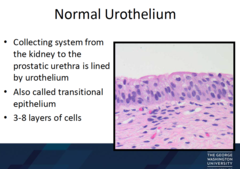 What is bladder lined by (cells)?