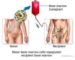 What is bone marrow transplantation?