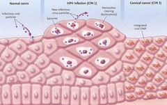 What is the basic life cycle of the HPV virus in the cervix?