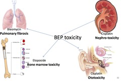 What is the BEP regimen toxicity profile?