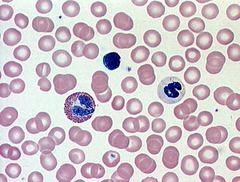 What type of white blood cell is shown